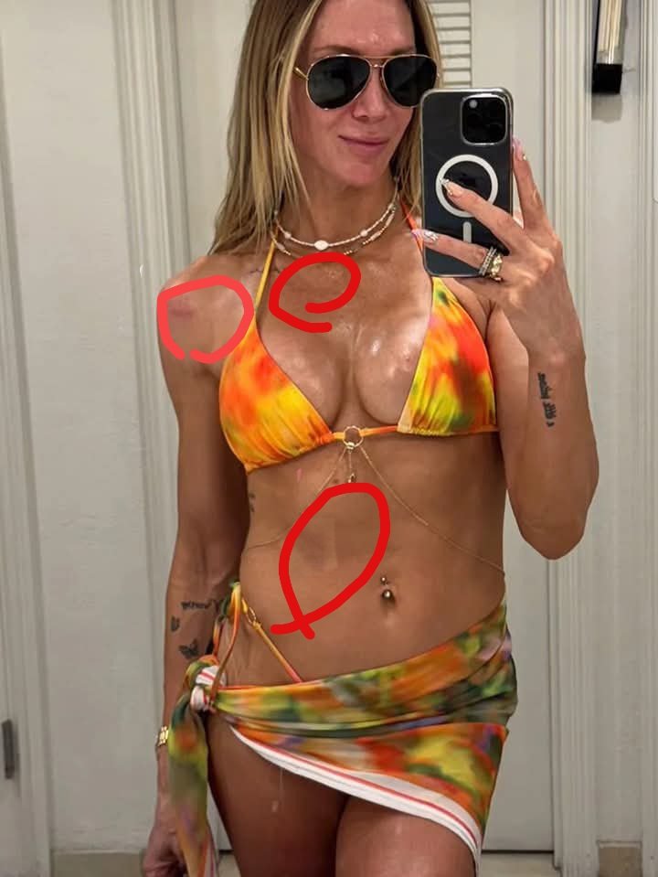 “Mysterious Marks on Charlotte Flair’s Body Spark Speculation — Fans Wonder: Accident or Something More?”