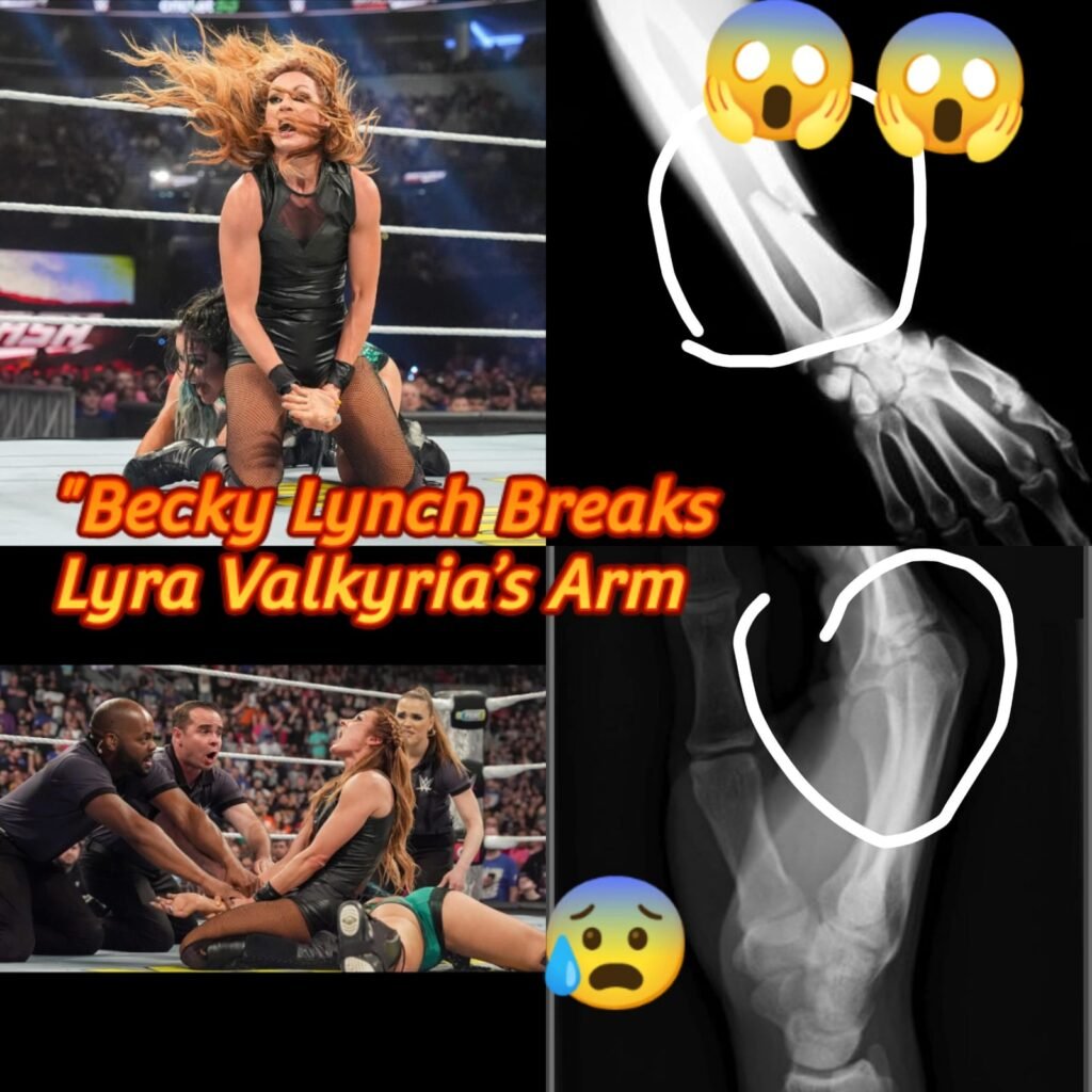 “Broken Bonds: Becky Lynch Shatters Lyra Valkyria’s Arm and Their Respect”