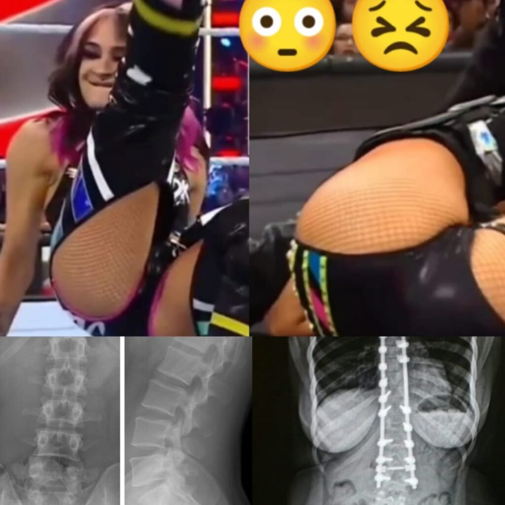 Dakota Kai Suffers Serious Spine Injury During WWE Match