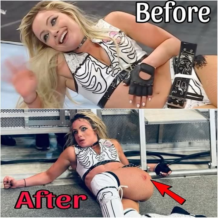 💔 Liv Morgan Breaks Silence with Brutal Injury Update After Elimination Chamber – How Long Will She Be Out of WWE?