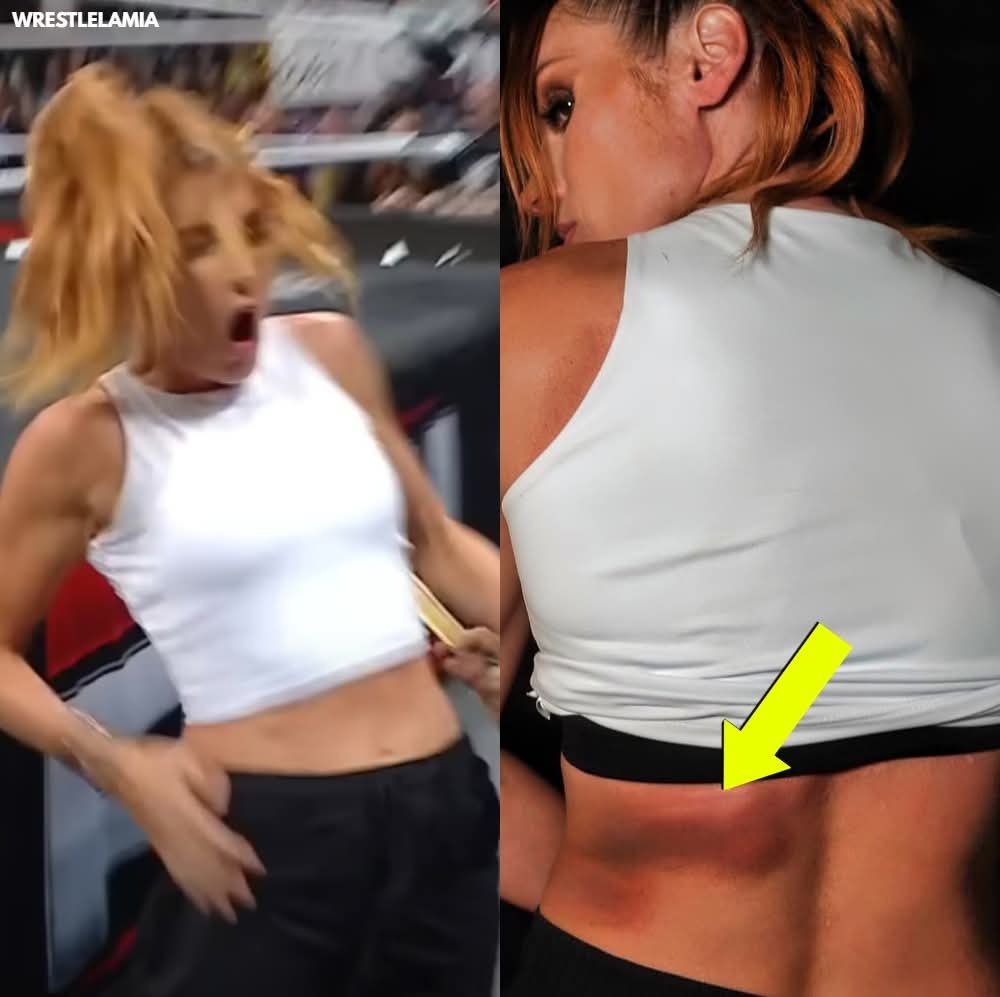 Becky Lynch Shows Off Brutal Battle Scars After Lyra Valkyria’s Kendo Assault – War of the Irish Warriors”